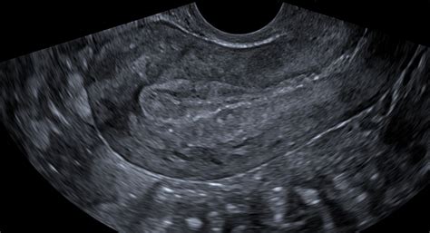 shukran diagnostics photos|An ultrasound pelvis scan is a non.